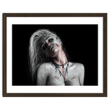 Vampire Bite thumbnail