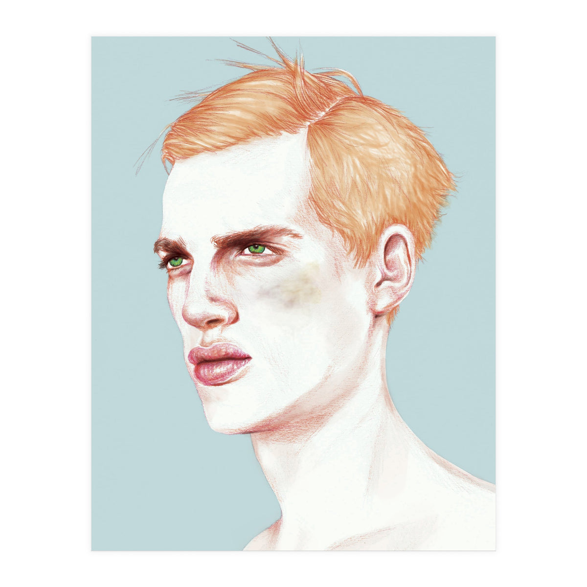 Boy Bruised (Print Only)