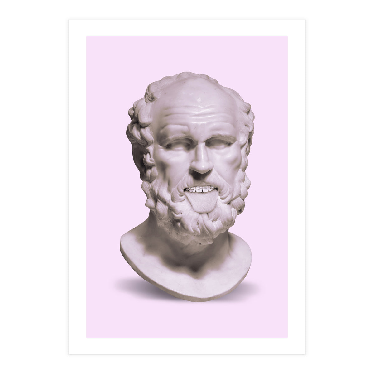 Braces Bust (Print Only)