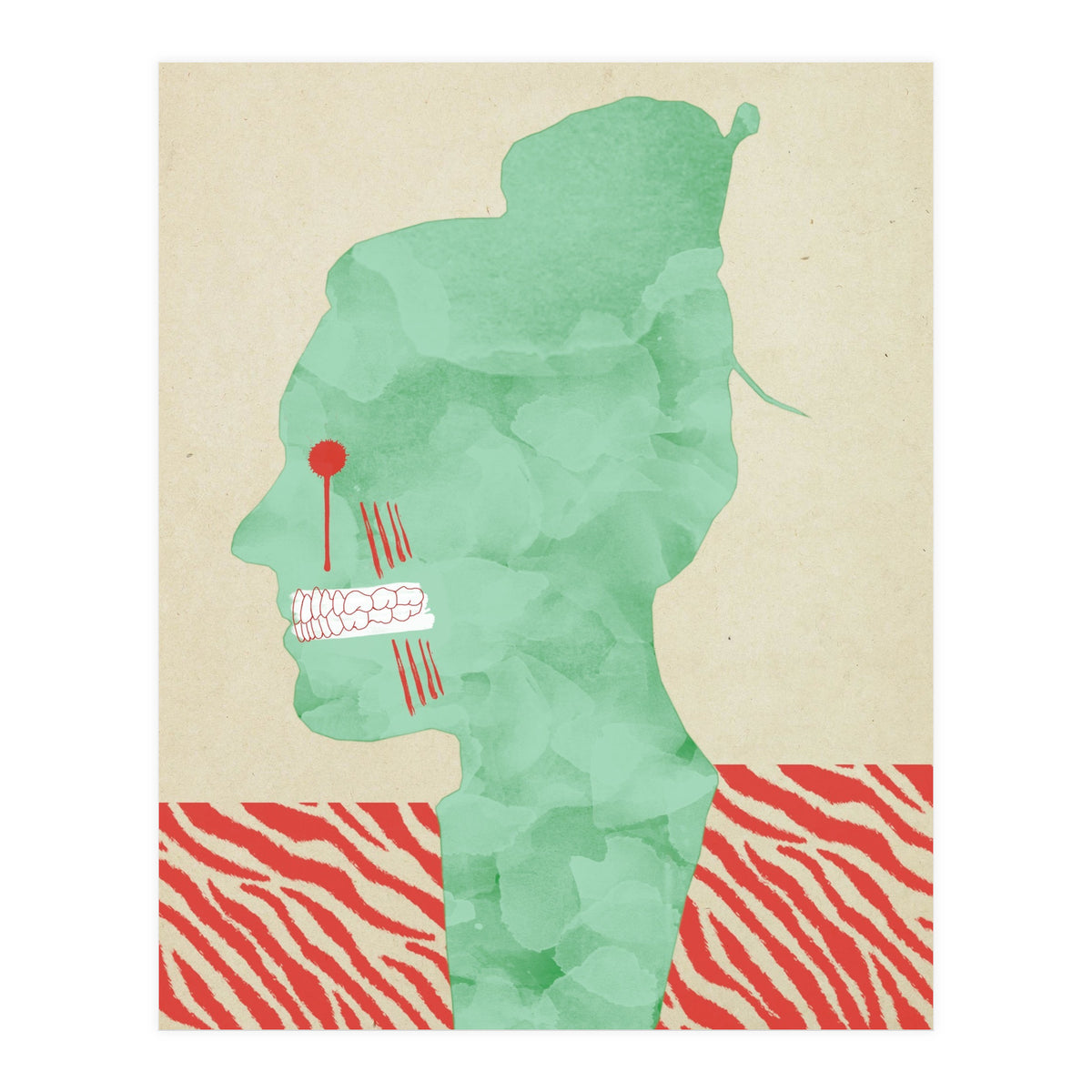 Bruxism (Print Only)