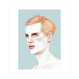Boy Bruised (Print Only) thumbnail