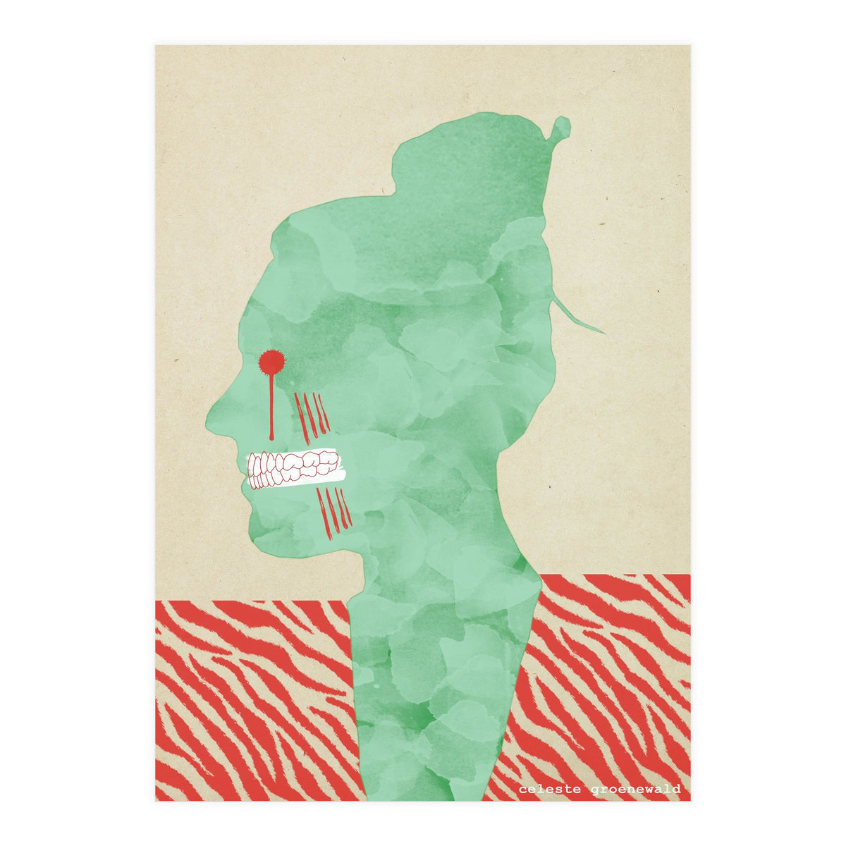 Bruxism (Print Only)