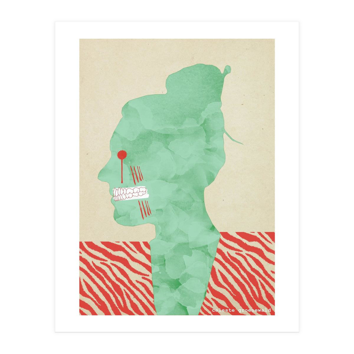 Bruxism (Print Only)