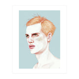Boy Bruised (Print Only) thumbnail